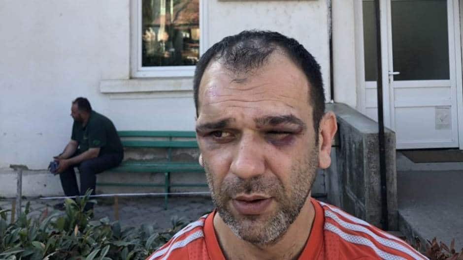 Напредни фашисти пребили организатора протеста опозиције у Житорађи! Напредни фашисти пребили организатора протеста опозиције у Житорађи!