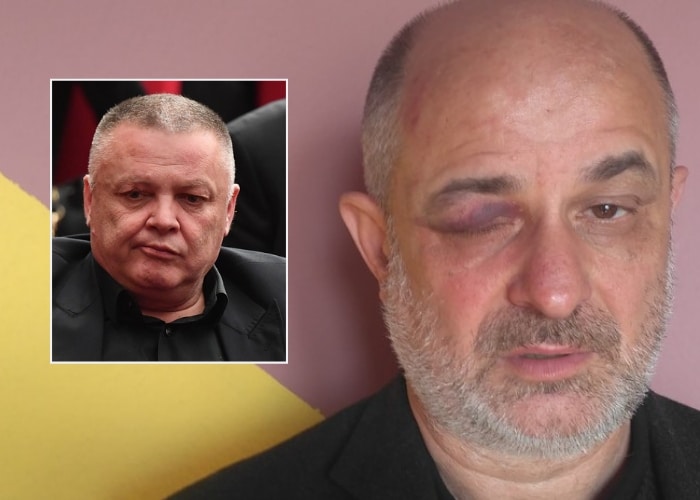 Претучен организатор протеста у Неготину јер је помињао Вучићевог батинаша Зорана Миливојевића Зељу Претучен организатор протеста у Неготину јер је помињао Вучићевог батинаша Зорана Миливојевића Зељу