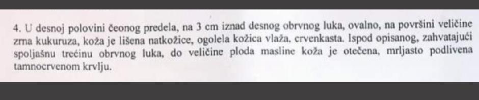 ОБДУKЦИОНИ НАЛАЗ ВЛАДИМИРА ЦВИЈАНА: Све се зна, ево шта се догодило са Цвијаном (ФОТО)